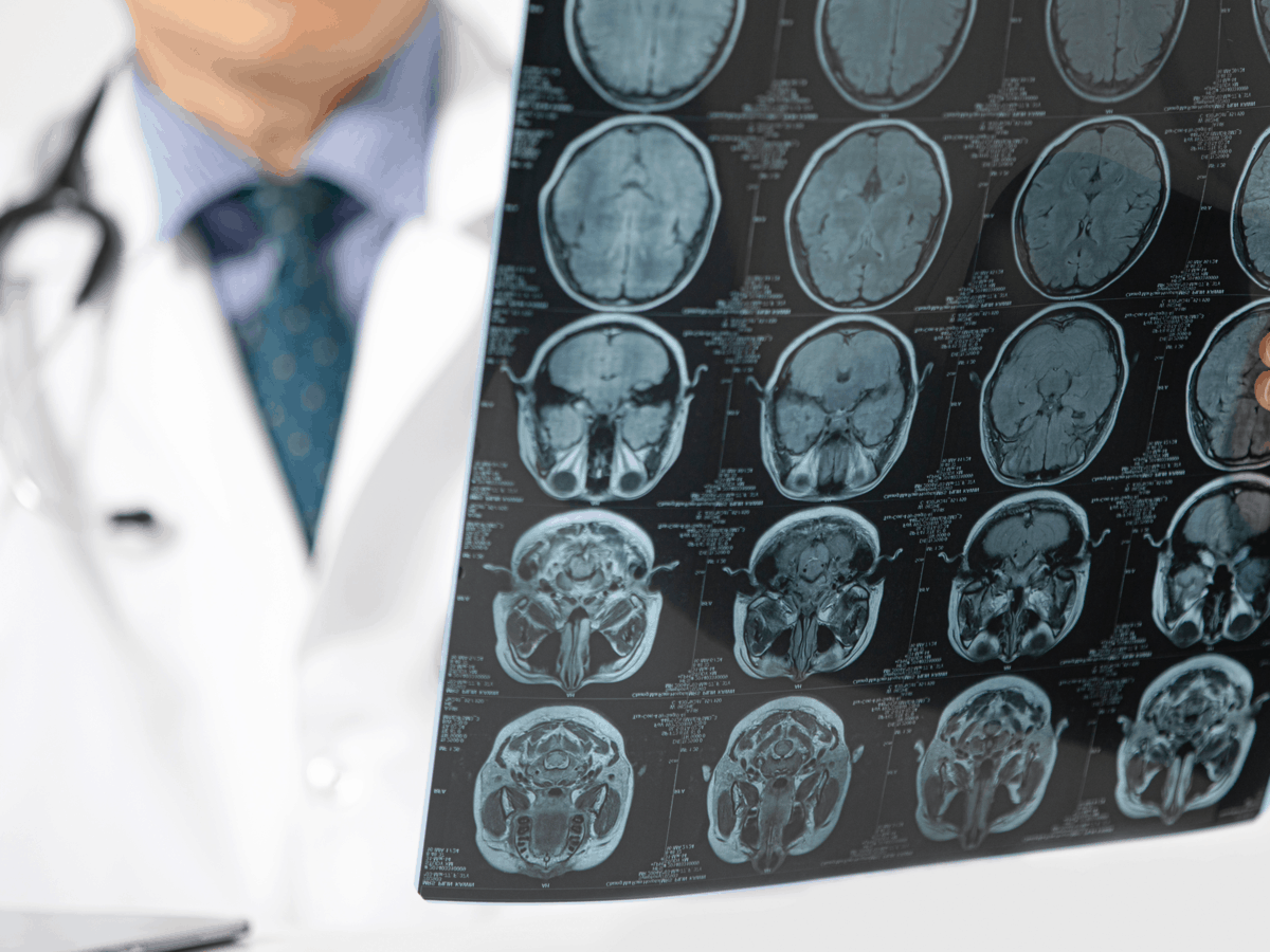 What is Neurosurgery? Find the Answer - Orlando Neurosurgery