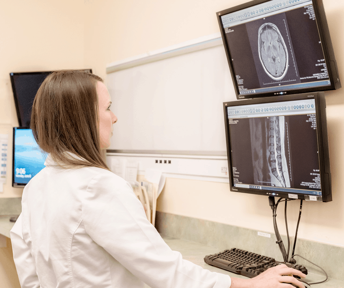 Specialist examines x-rays before performing vascular neurosurgery.