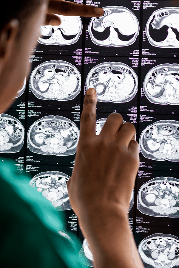 Technician examines brain scan for tumors