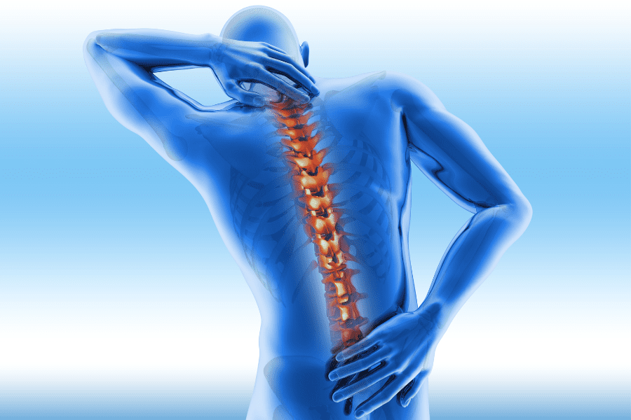 Animated rendering of back pain, which could benefit from Spinal Cord Stimulation 