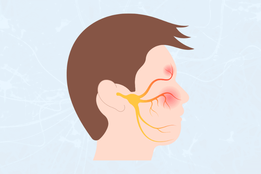 illustration of nerves connecting the brow, nose, and ears